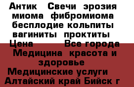 Антик.  Свечи (эрозия, миома, фибромиома, бесплодие,кольпиты, вагиниты, проктиты › Цена ­ 550 - Все города Медицина, красота и здоровье » Медицинские услуги   . Алтайский край,Бийск г.